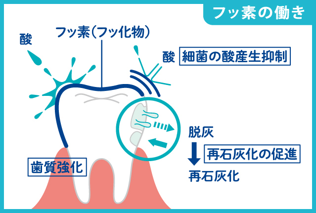 【小児歯科医監修】子どものフッ素はなぜ虫歯予防に効くの?使い方と歯科での塗布｜みかげ小児歯科・矯正歯科クリニック｜御影